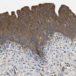 STAT2 Antibody, Novus Biologicals 0.1mL; Unlabeled:Antibodies, Polyclonal